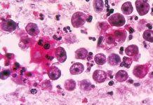 যুক্তরাষ্ট্রে ভয়ঙ্কর মগজ খেকো অ্যামিবার খোঁজ, ৭ দিনেই নিশ্চিত মৃত্যু!