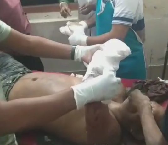 কলাপাড়ায় শ্রমিক লীগ নেতার হাত কেটে নিল সন্ত্রাসীরা