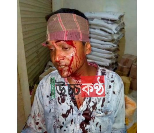চুনারুঘাটে সাংবাদিকের উপর অতর্কিত হামলা, রক্তাক্ত জখমসহ টাকা-মোবাইল ছিনতাই!